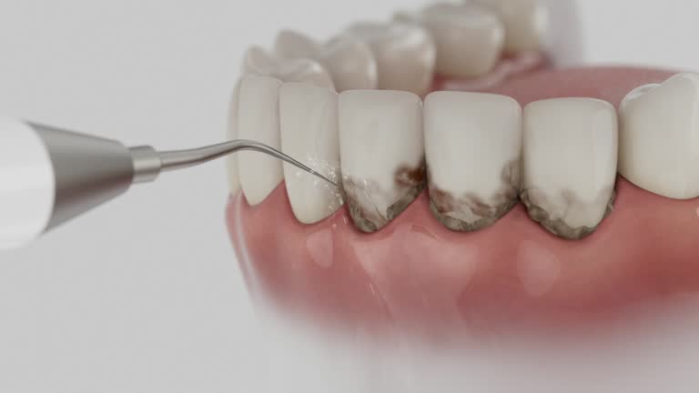 Reliable Dental Implants contractor in Robinwood, MD by Smile Center Dentistry